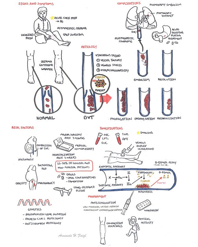Deep Vein Thrombosis (DVT) - Overview - Manual of Medicine