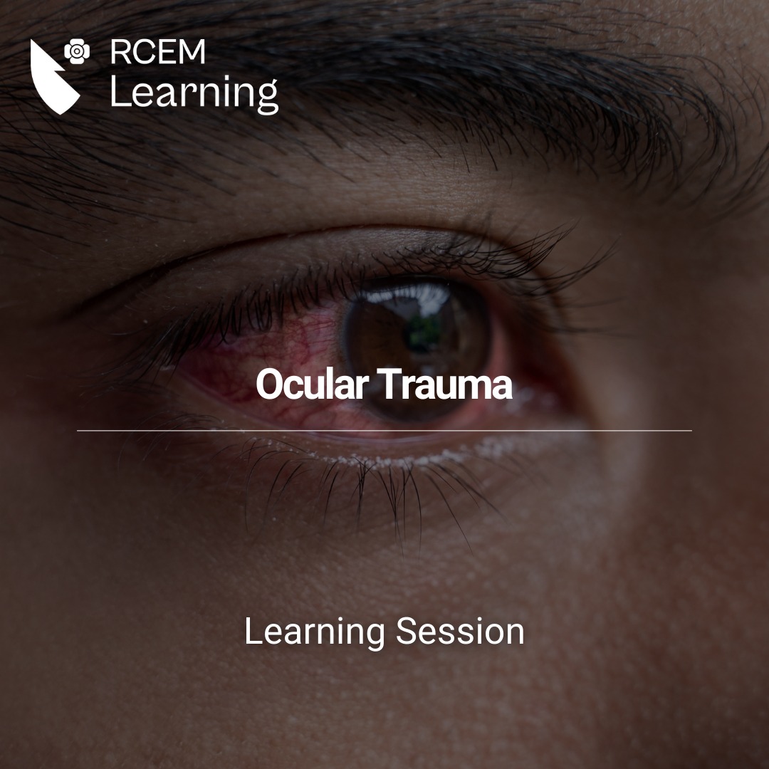 RCEMLearning - NEW: This module covers key points in common ocular ...