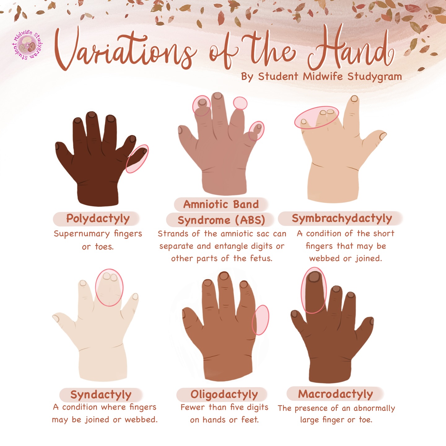 👋🏾 Variations of the Hand 👋🏼... - Student Midwife Studygram