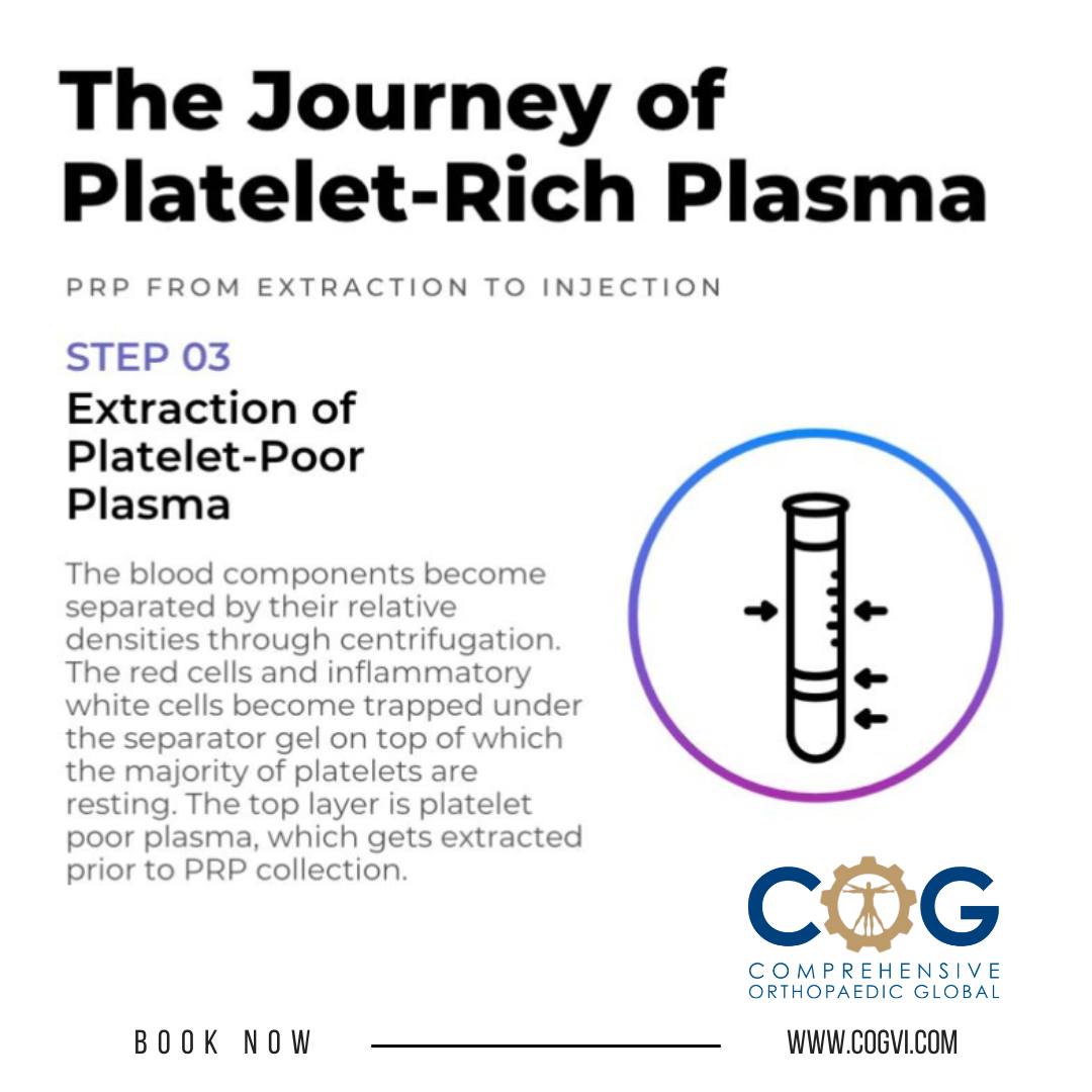 Comprehensive - What is PRP? Extraction of Platelet-Rich Plasma After ...