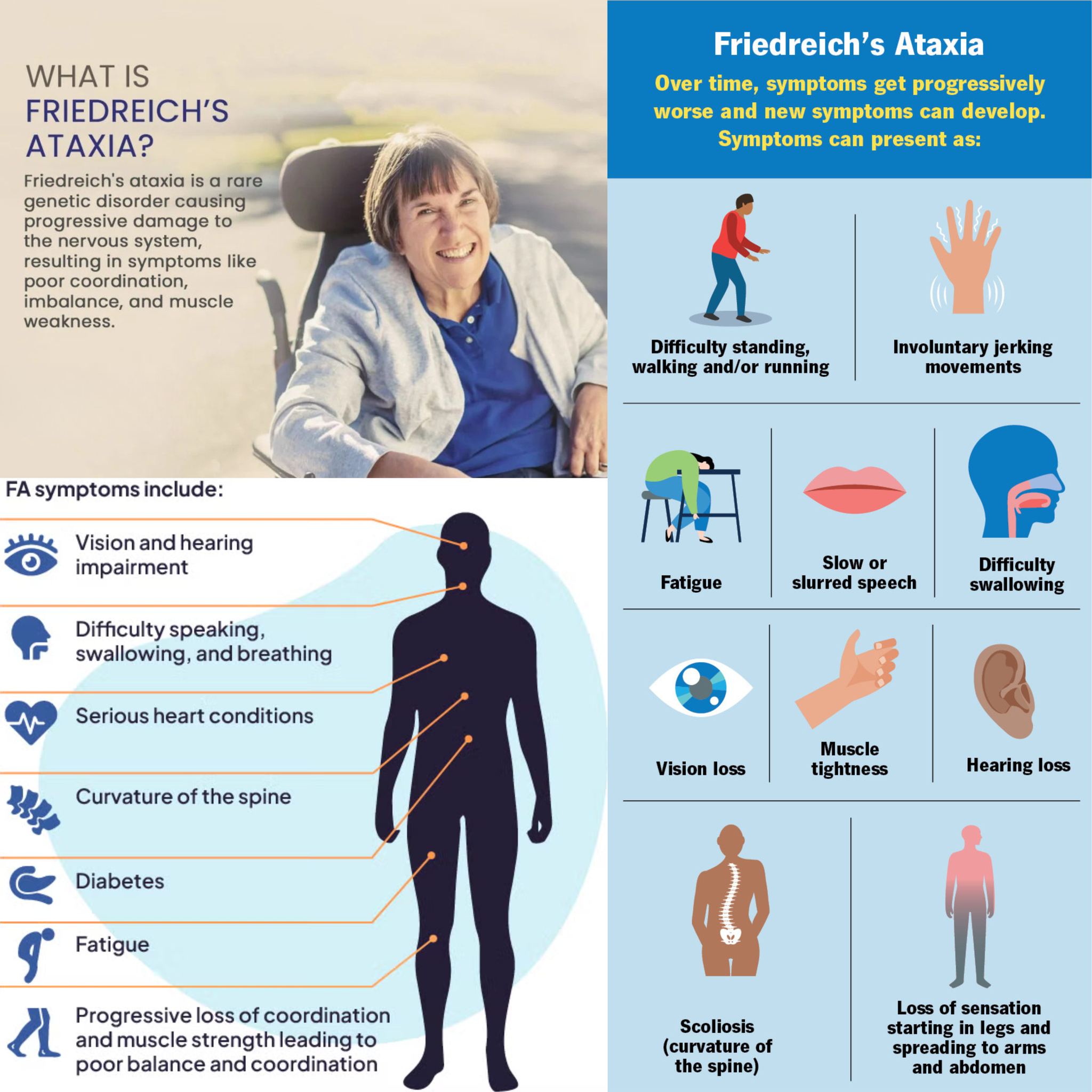 Friedreich's ataxia (FA)** is a hereditary neurodegenerative