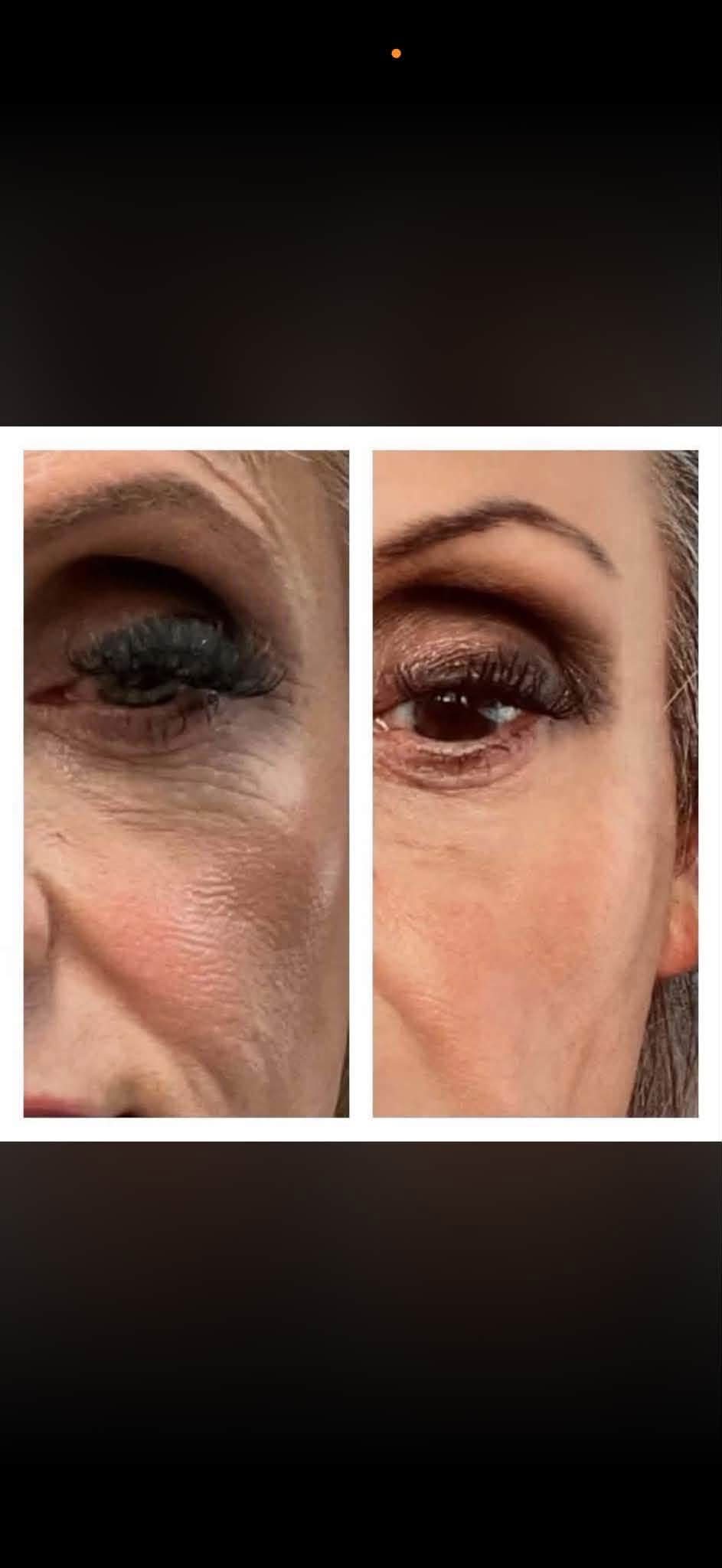 glutathione wrinkles Glow starts on your plate ✨ #Beauty #Glutathione electrolites