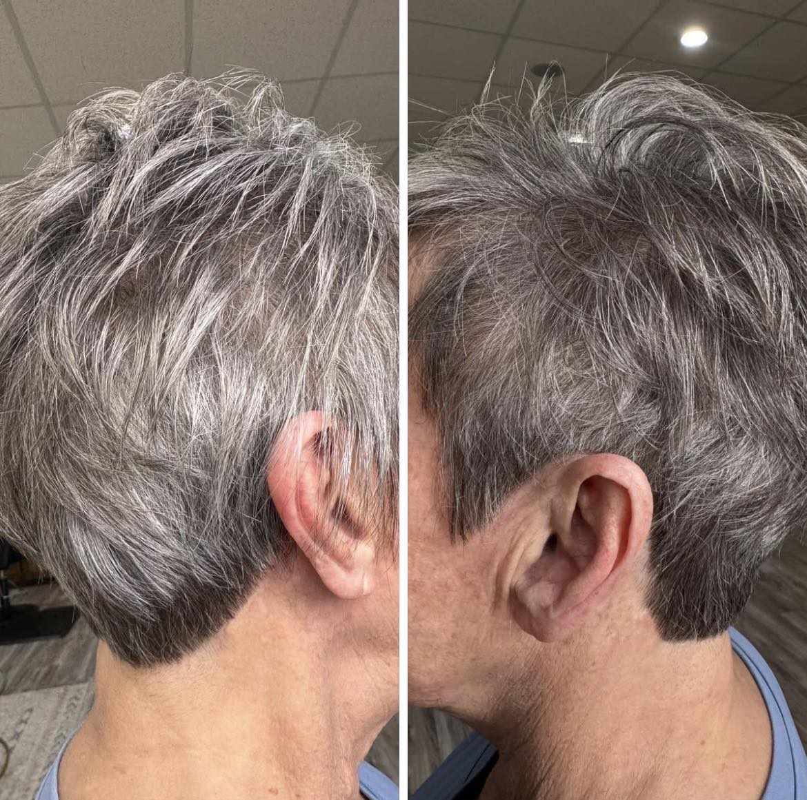 Which is better for hair loss, Klow or Glow?