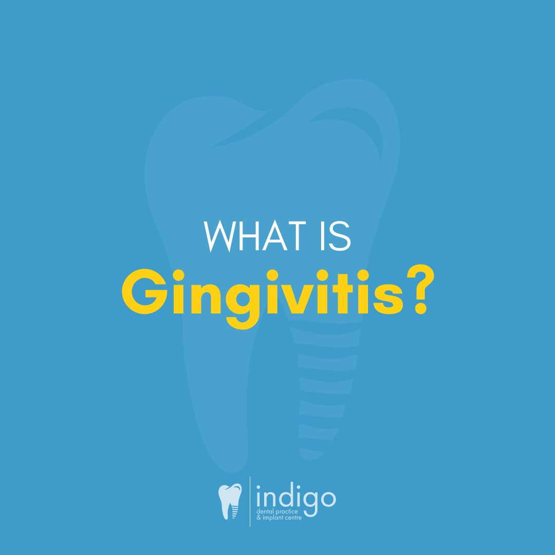 Indigo - Gingivitis is a common and mild form of gum disease that ...