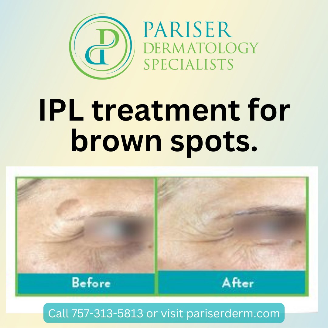 Some of the most common... - Pariser Dermatology Specialists
