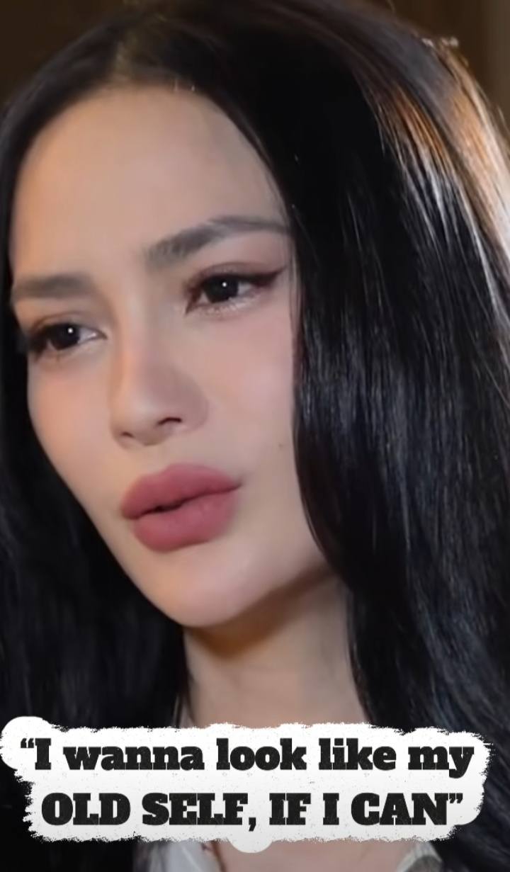 In a past interview, Arci Muñoz shared an honest reflection about her journey with cosmetic enhancements—saying she sometimes wishes she could return to her natural, earlier look, and that if someone had
