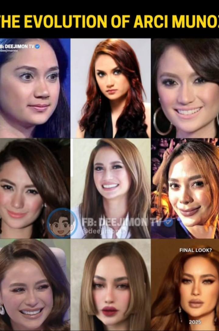 arci munpz.glutathione In a past interview, Muñoz shared an honest reflection about her journey with cosmetic enhancements—saying she sometimes wishes she could return to her natural, earlier look, and that if someone had BPC-157 10 MG -