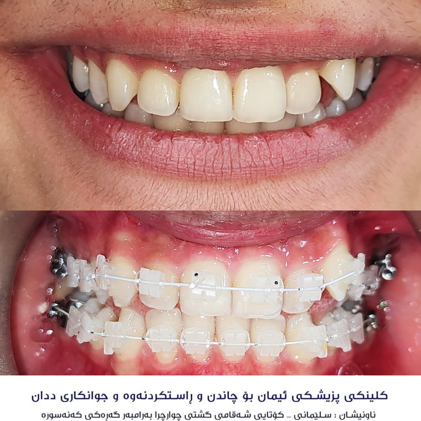 د. - دیمەنەکان خۆیان دەدوێن .. تەنها سەیری ئیشەکانمان بکەن دواتر بڕیار ...