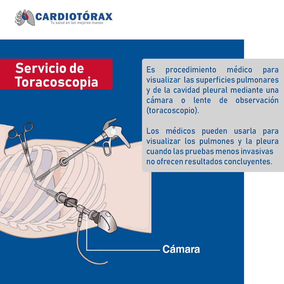 La... - Dr. Jonhy Robles - Cirujano Cardiovascular y de Tórax