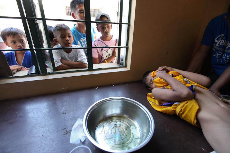 ABS-CBN - A boy in pain covers his face while getting circumcised as ...