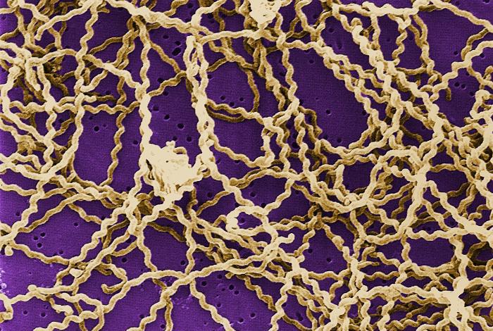 American Society for Microbiology - Picture of the Day: Leptospira sp ...