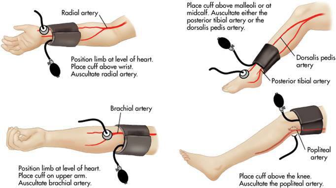 brachial-artery-blood-pressure