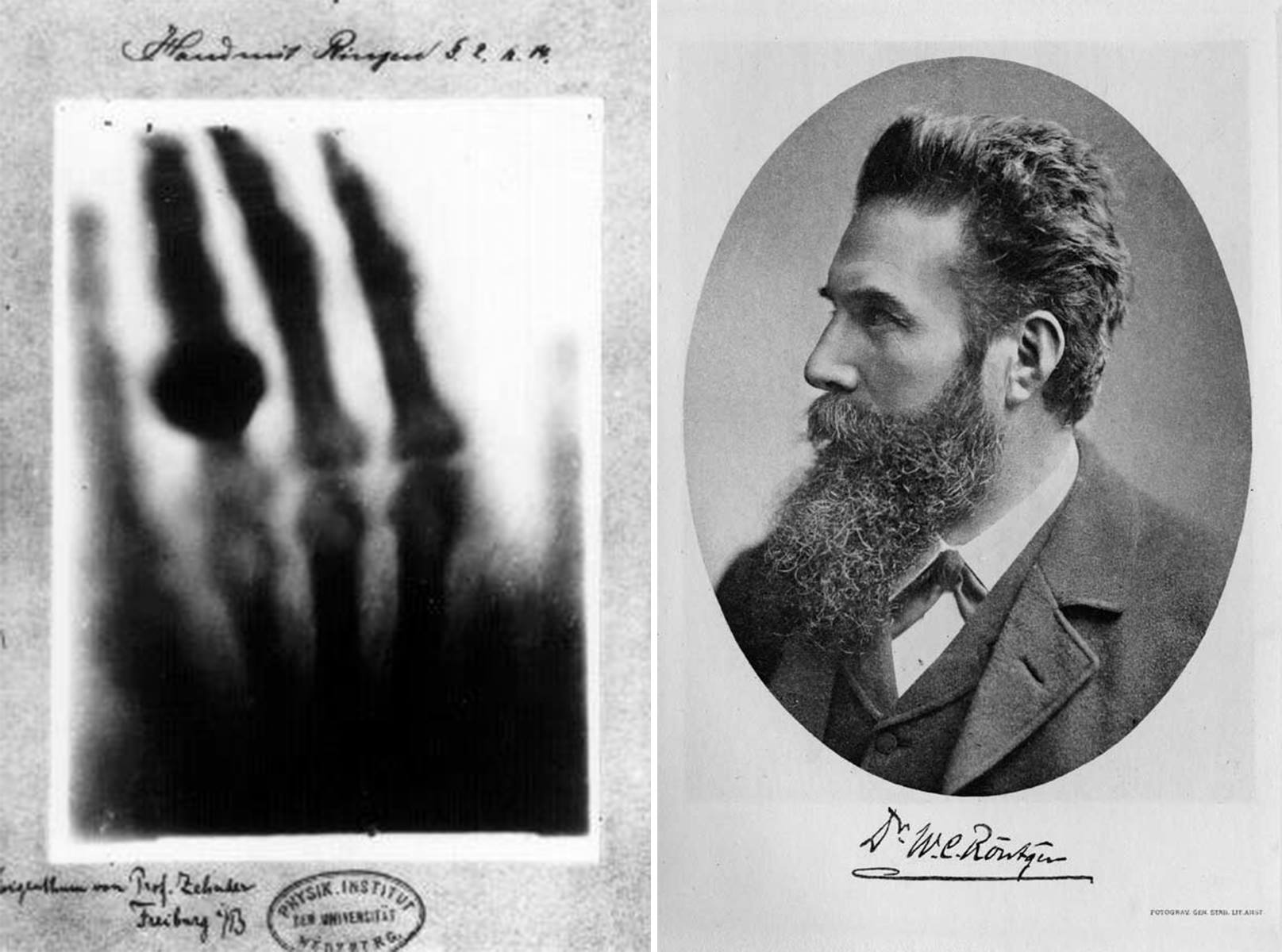 Nobel Prize - To the left, one of the most famous images in ...