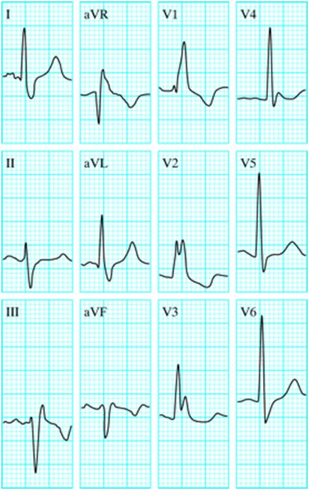 House Rabbit Society | A little happiness can even be found in an ECG ...
