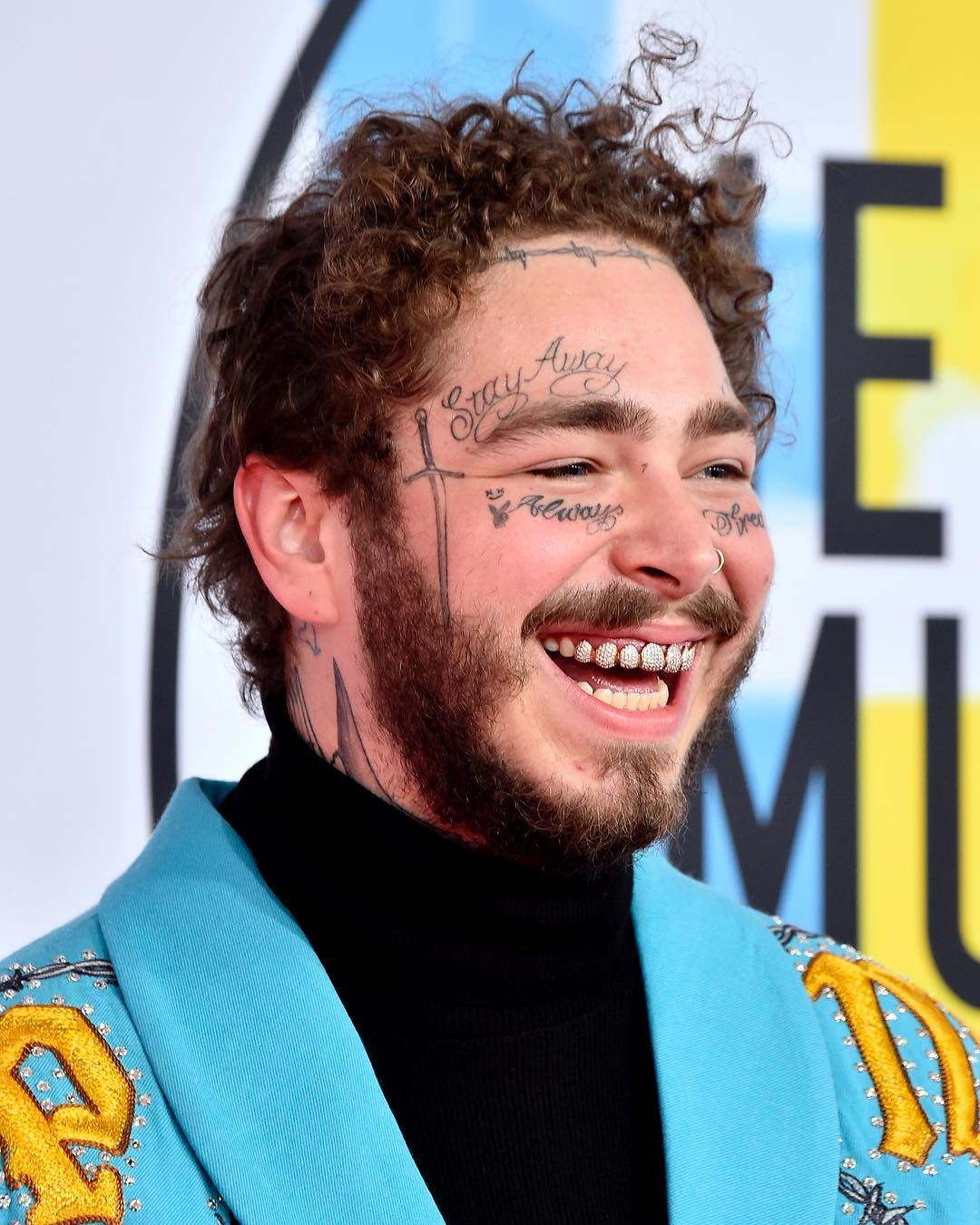Dentes De Rapper Antes E Depois Cantor Implanta Dentes De Vampiro E
