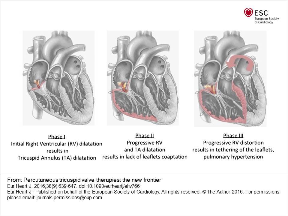 #ESCardioEd... - European Society of Cardiology