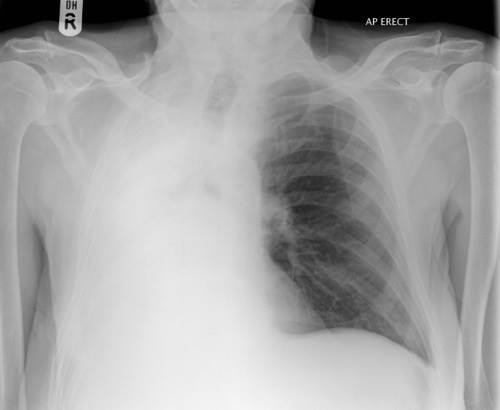 Naser - An 82-year-old man is admitted with a three day history of ...