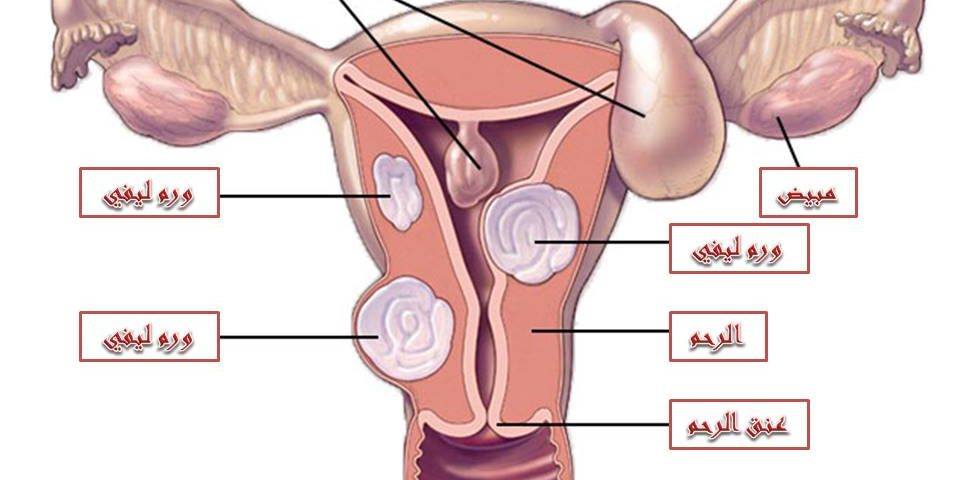 تعرف على التصاقات الرحم وأسباب دكتور جميل القدسي الدويك فيسبوك