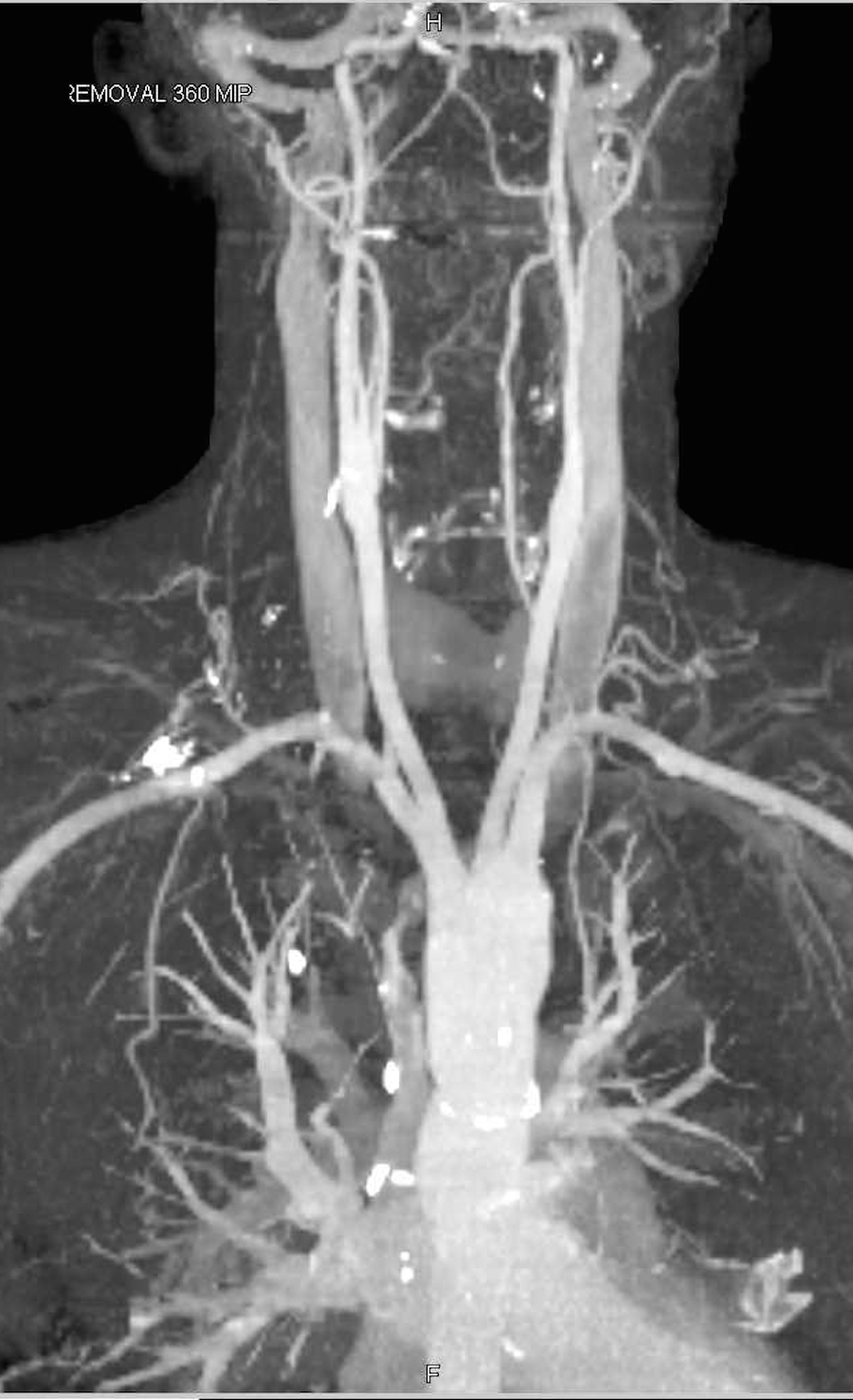 CTisus: Cutting edge information on body CT (Computed tomography ...