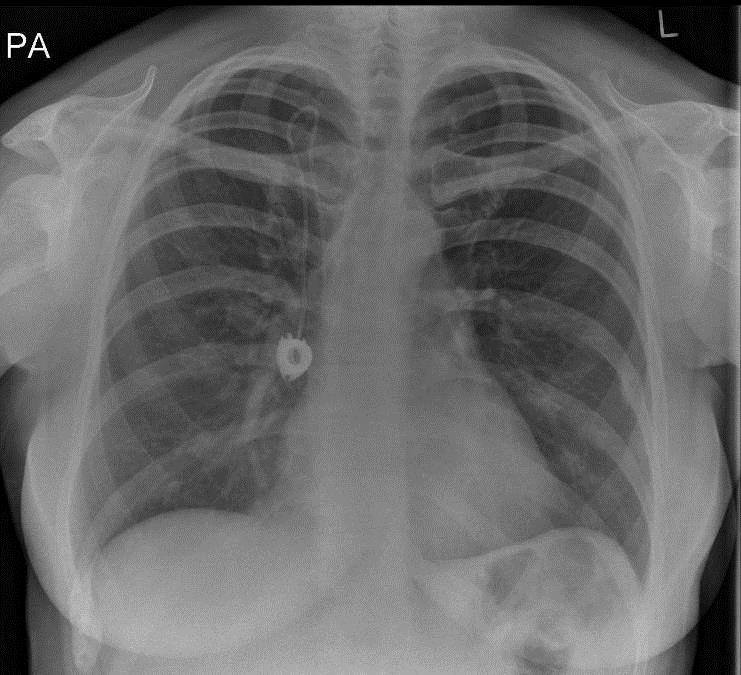 Challenge yourself with... - European Respiratory Society
