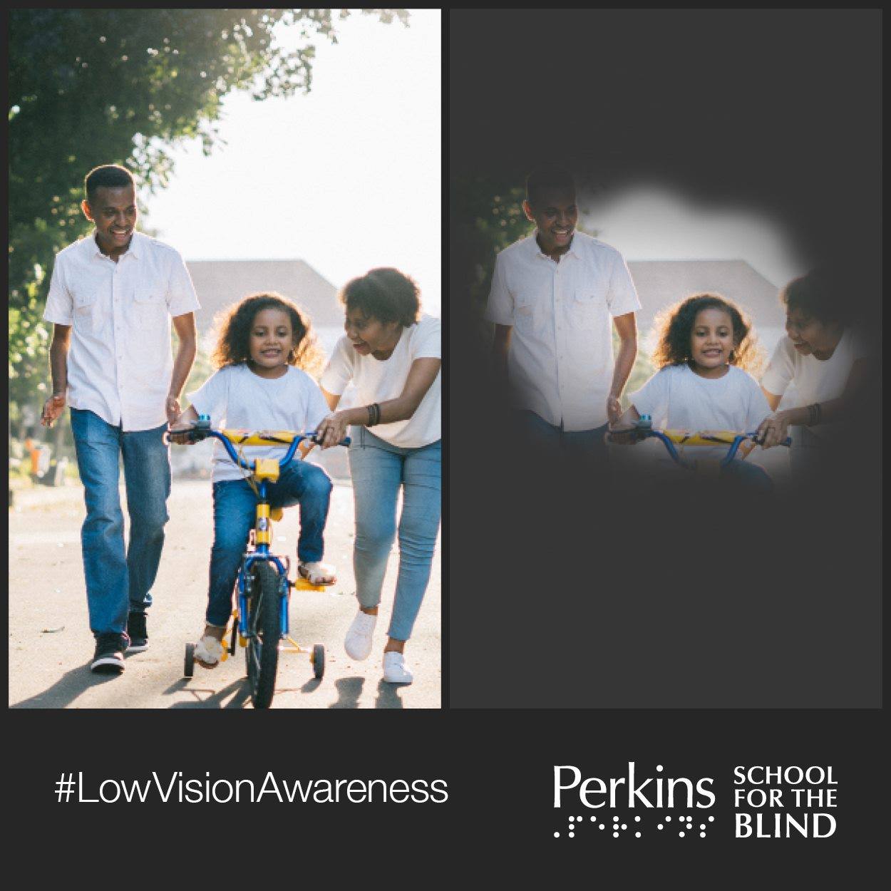 Glaucoma can cause vision... - Perkins School for the Blind | Facebook
