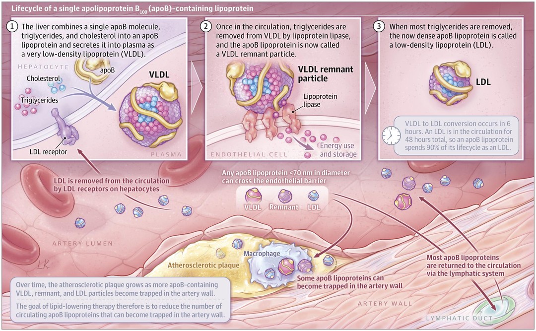 JAMA - New Understandings of Dyslipidemia in 2020 The trapping of an ...