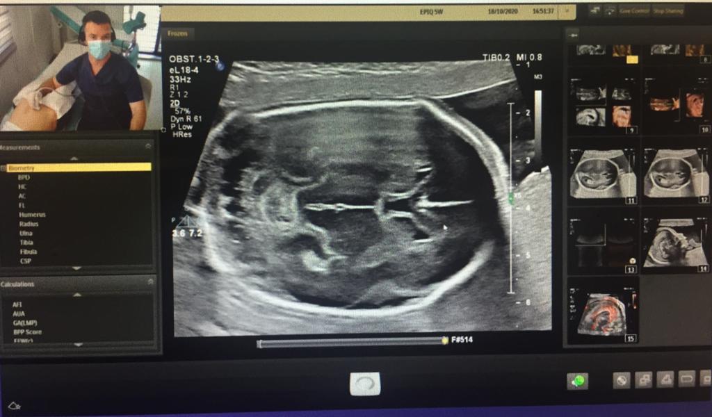 Some images from the live scan : brain scan examples by Dominic Iliescu ...