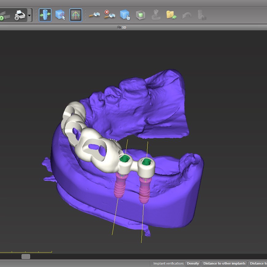 Dr Andrew Legg - Implants and Smile Design