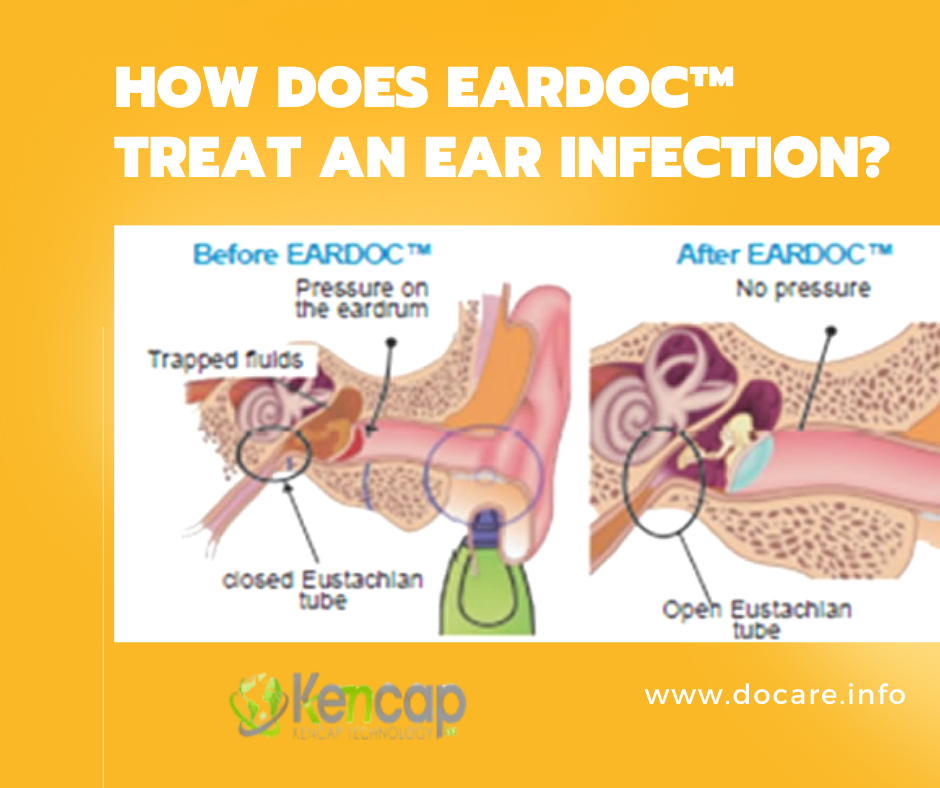 Docare - EARDOC™ generates and transmits vibration waves... | Facebook