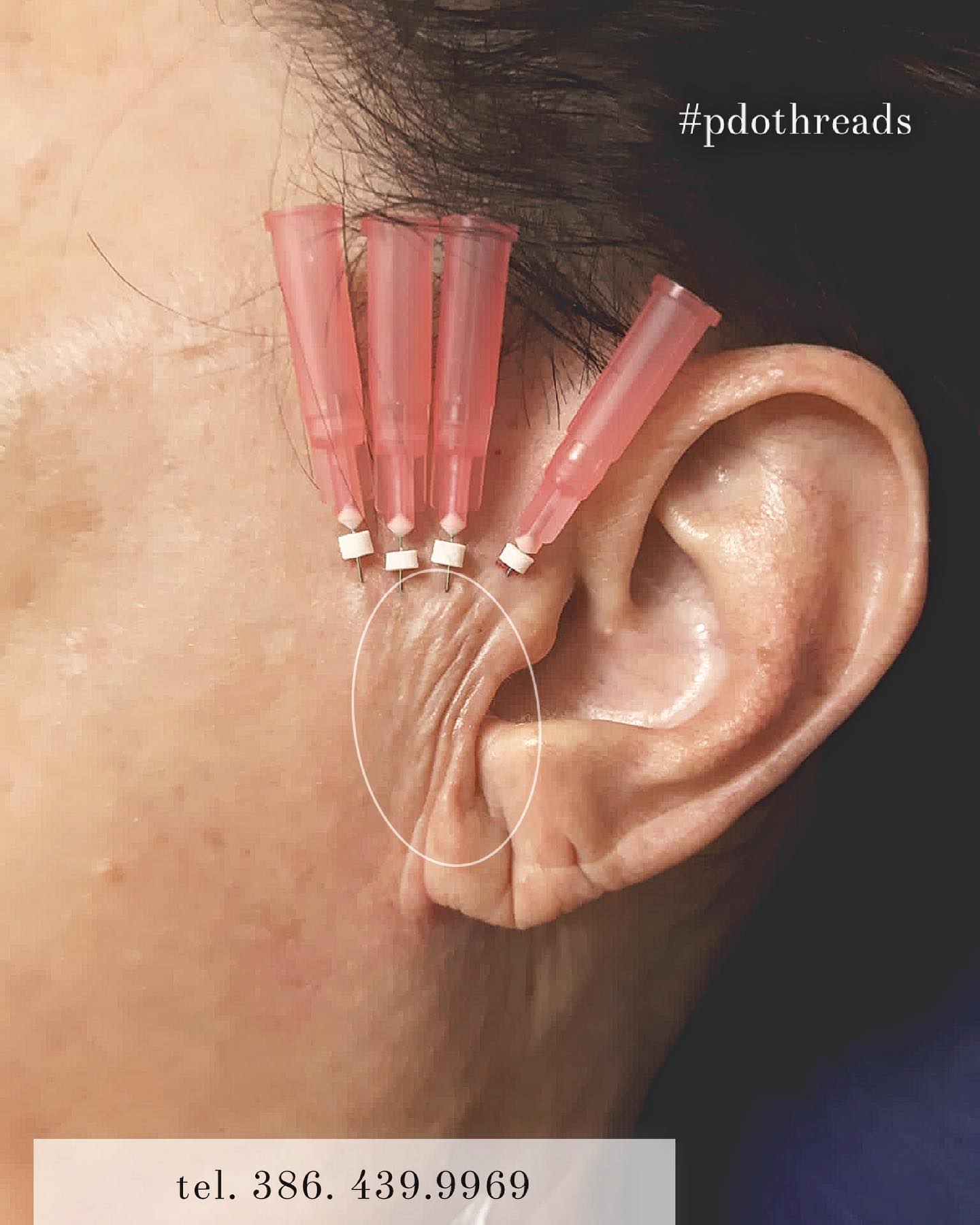 Do you have deep diagonal... - Allure European Day Spa