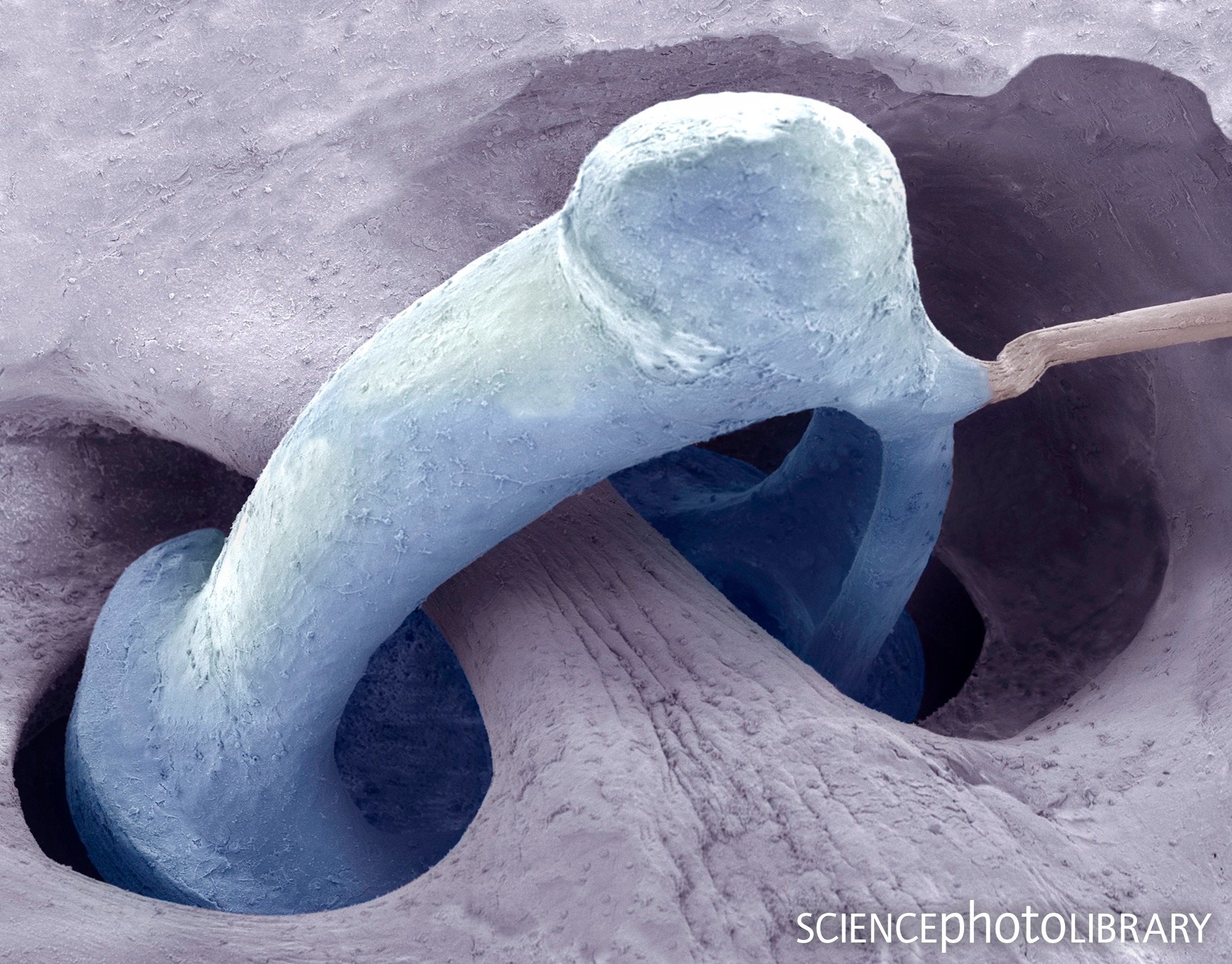 Science Photo Library - A great capture by Steve Gschmeissner, showing ...