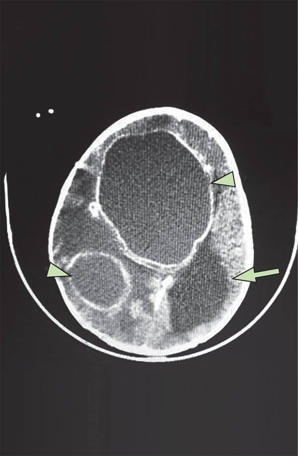 The Lancet - The Lancet | Picture Quiz | Remarkable recovery in infant ...