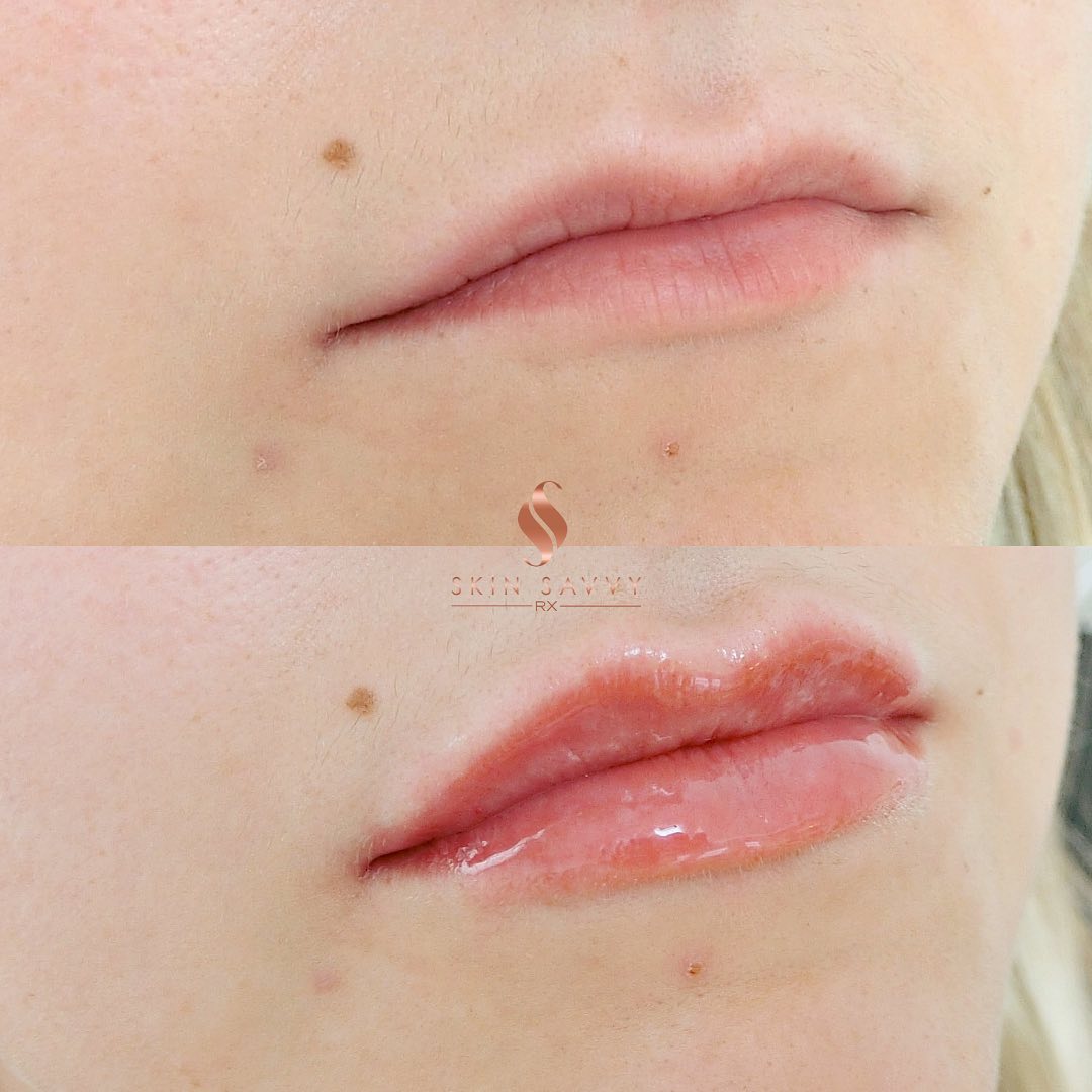 Skin Savvy Rx - We love these lips so much! 😍 Our... | Facebook
