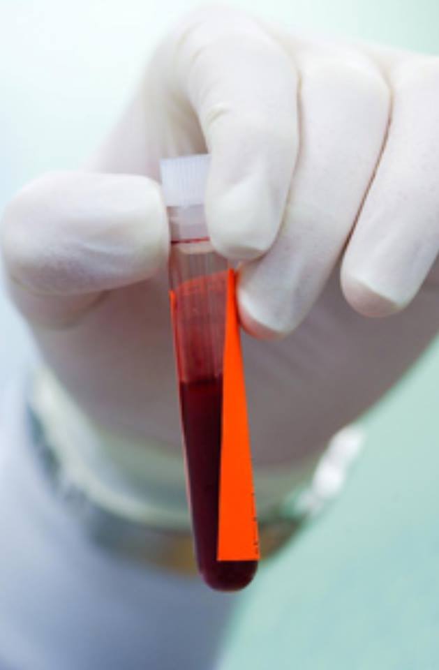 Do... - Society for the Advancement of Blood Management (SABM)