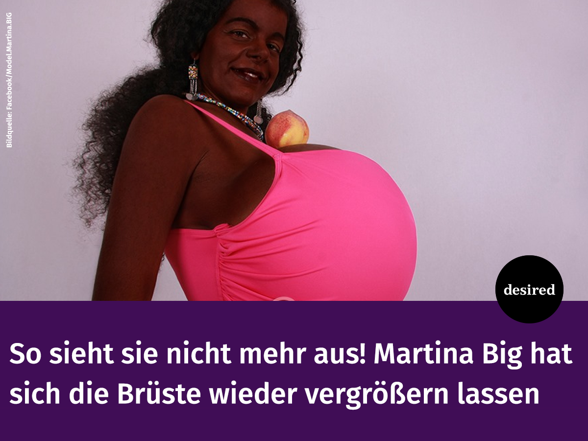 Dieses Bild zeigt die 31-Jährige VOR der OP