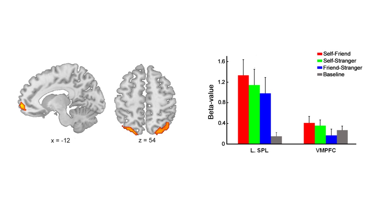 Ventromedial Prefrontal Cortex Ventromedial Prefrontal Cortex Art