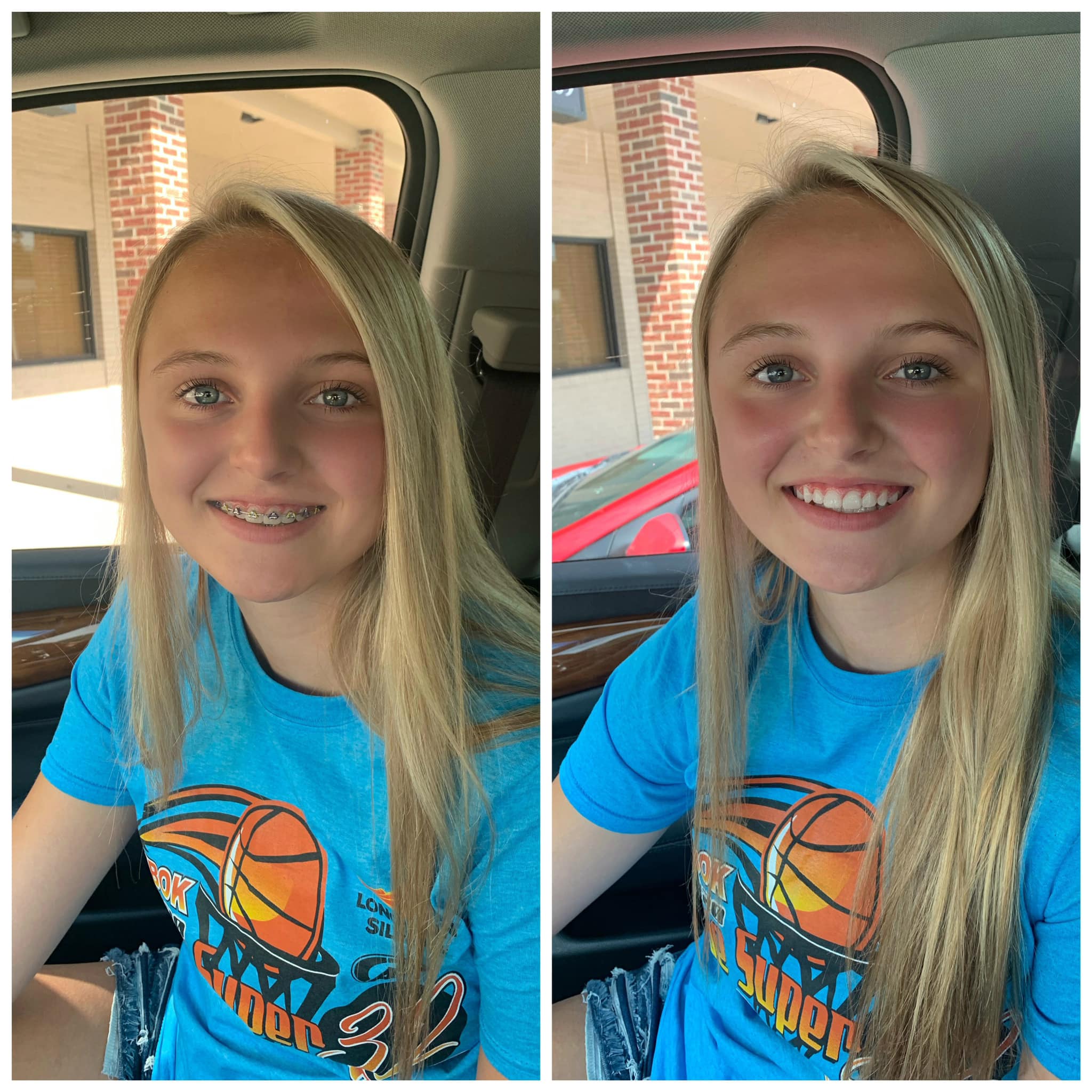 Lisa - Addi got her braces off today! We had the absolute best ...