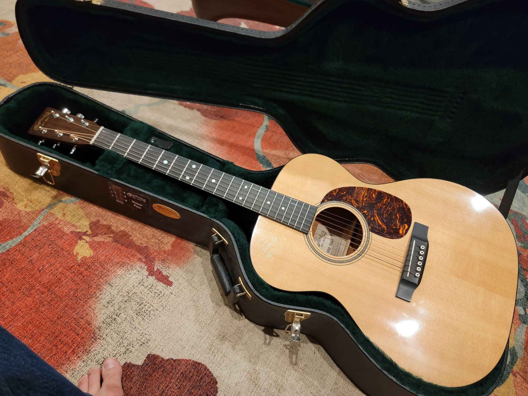 What are the differences between Martin 000X1RGT and rosewood