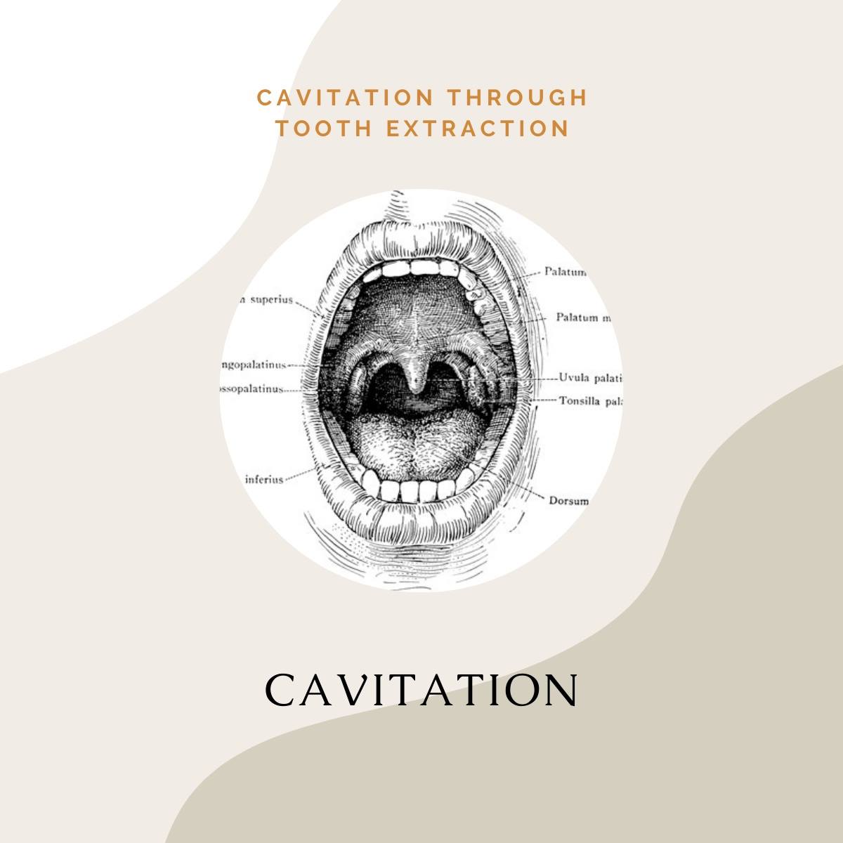 3 Angels Health Center - Have you heard of cavitation? Cavitation is a ...