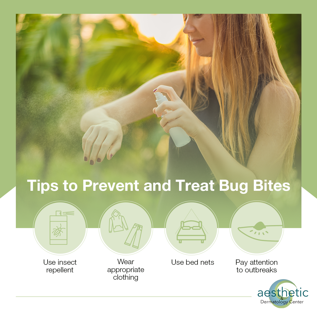 How to Prevent Bug Bites