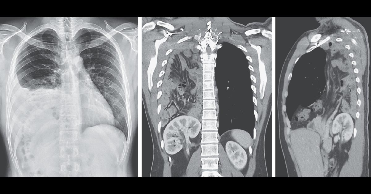 The New - An asymptomatic 25-year-old man presented to the emergency ...