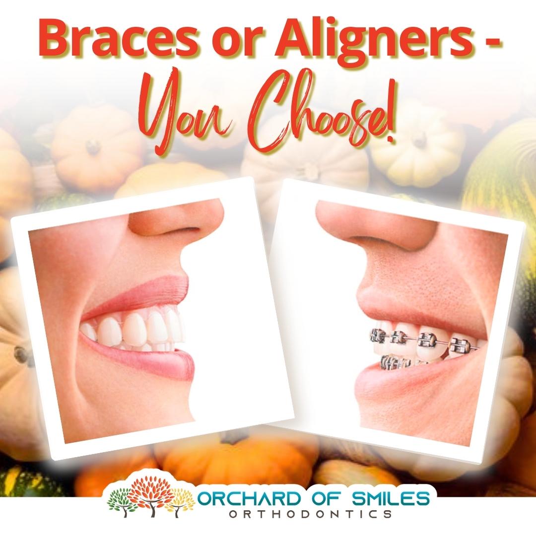 Thinking of starting orthodontic treatment but can't decide