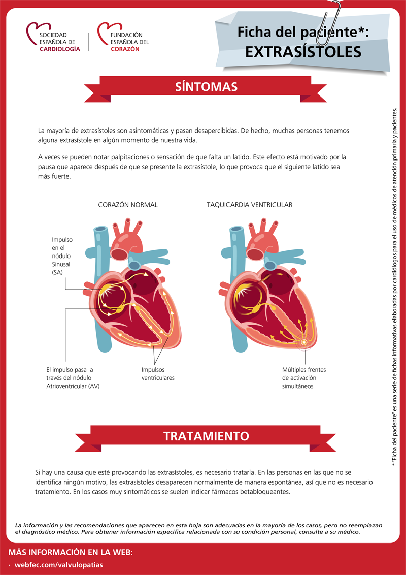 Fundacion Española del Corazón - ¿Sabes qué son las extrasístoles? ¿Y ...