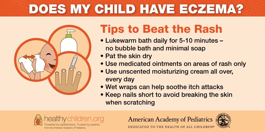 Healthy Children - Kids with eczema (atopic dermatitis) tend to get ...