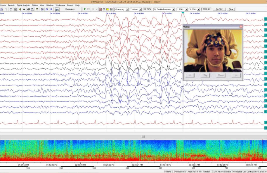 Neurovirtual