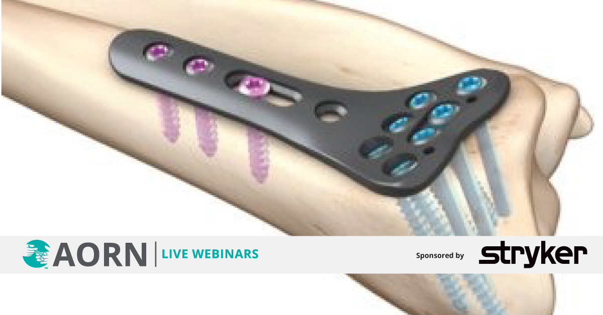 AORN - Understand the basic principles and biomechanics of fracture ...