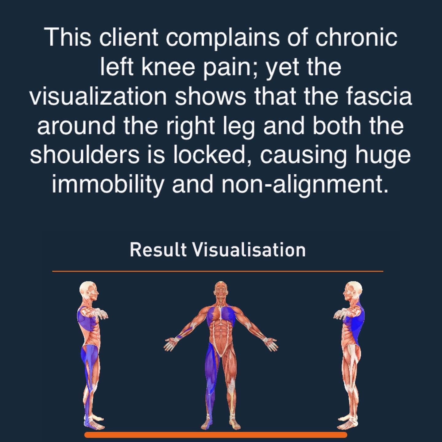 The Lyno Method - ITB is considered as one of the most...