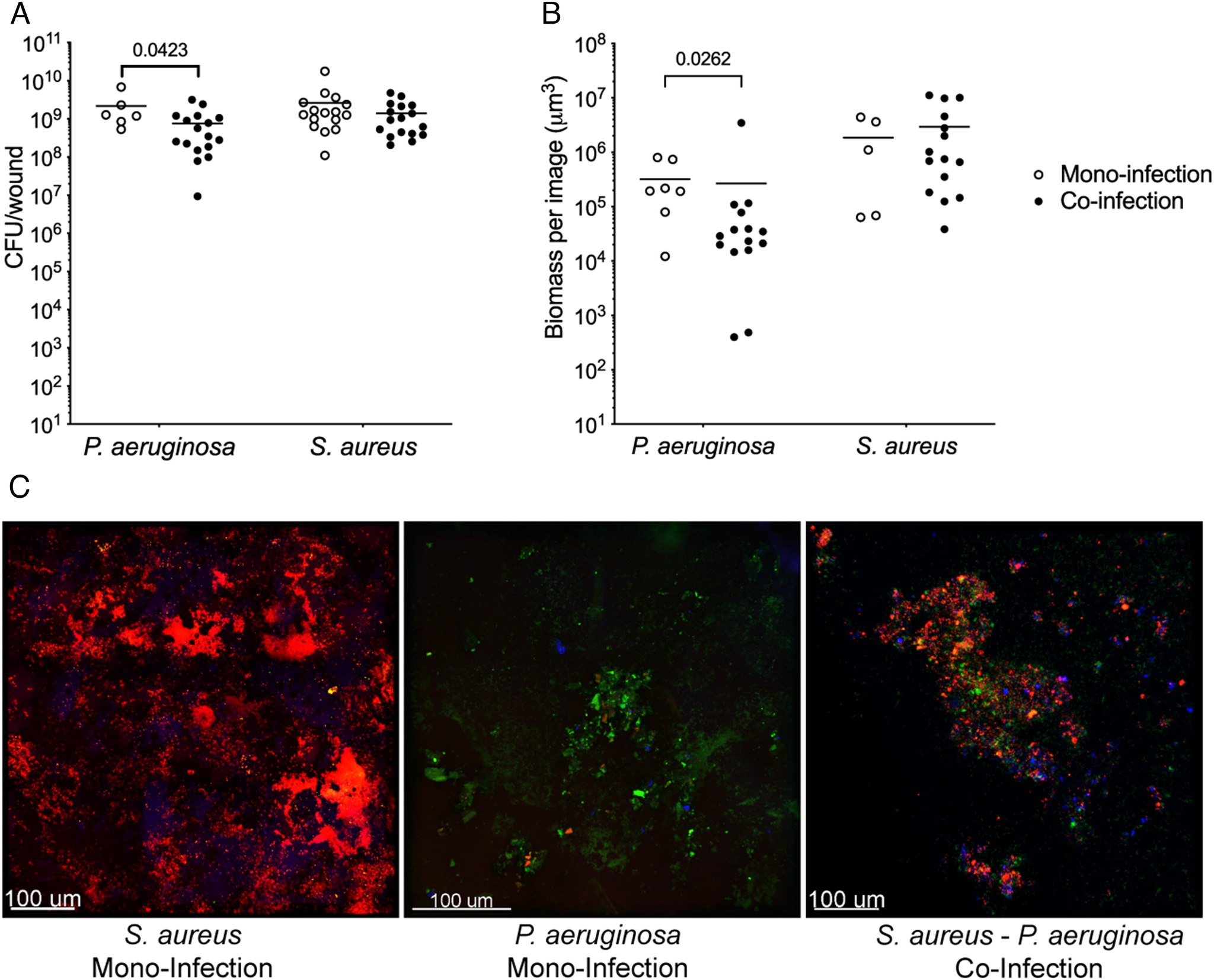 PNAS - Researchers characterize interactions between S. aureus and P ...