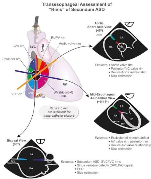 Cardiac imaging | Bangkok