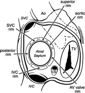Cardiac imaging | Bangkok